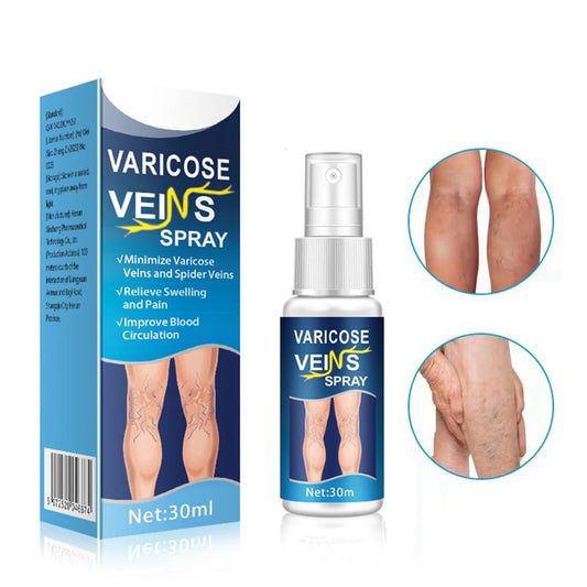 Natural Varicose Vein Relief Spray – 30ml Herbal Formula for Better Circulation & Comfort