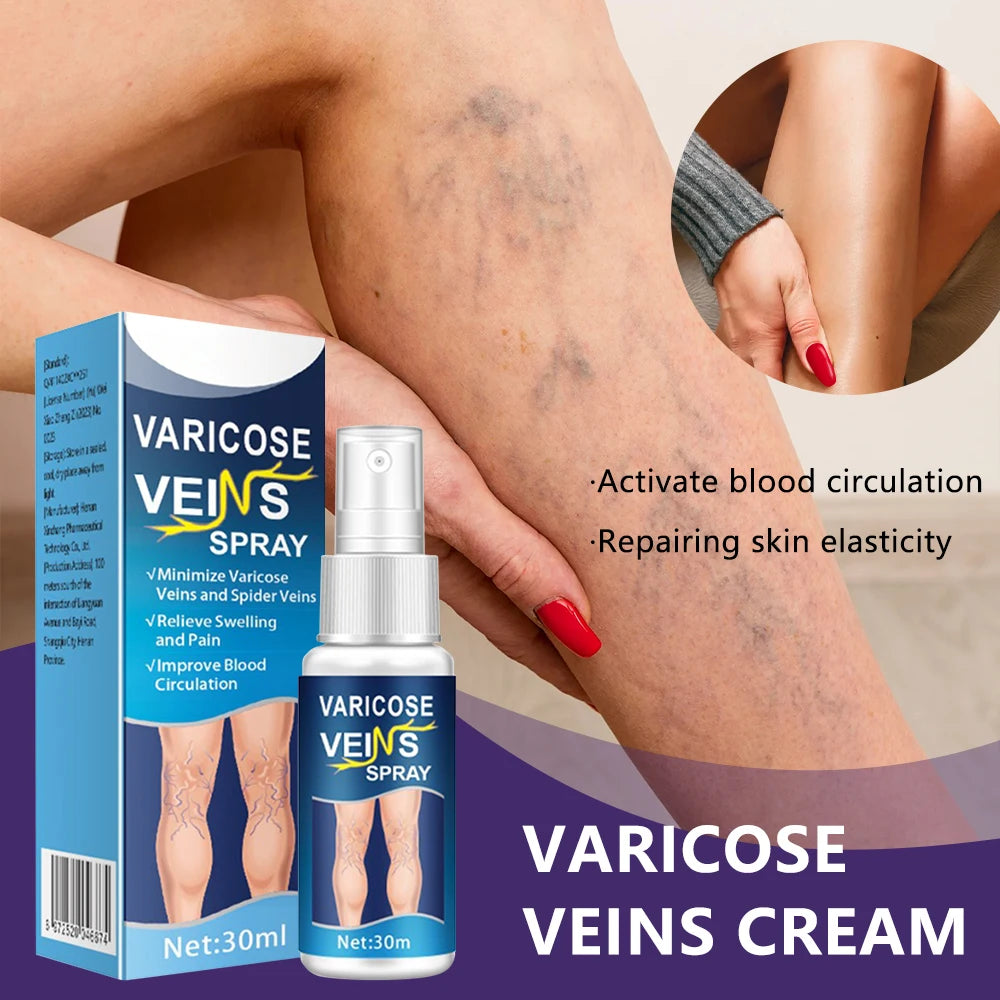 Natural Varicose Vein Relief Spray – 30ml Herbal Formula for Better Circulation & Comfort