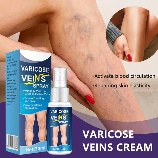 Natural Varicose Vein Relief Spray – 30ml Herbal Formula for Better Circulation & Comfort